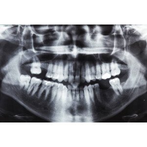 Umělecká fotografie Closeup x-ray image of teeth and mouth, jopstock, (40 x 26.7 cm)