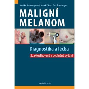 Maligní melanom - Diagnostika a léčba, 2.  vydání - Monika Arenbergerová