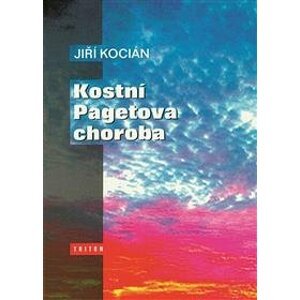 Kostní Pagetova choroba - Jiří Kocián