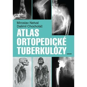 Atlas ortopedické tuberkulózy - Dalimil Chocholáč