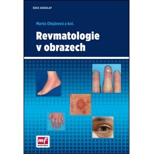 Revmatologie v obrazech - Marta Olejárová