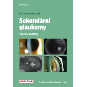 Sekundární glaukomy - Vybrané kapitoly, 2.  vydání - Klára Samková