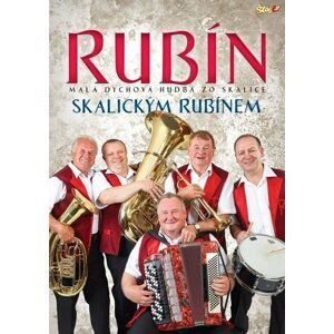 Rubín - Skalickým rubínem - DVD