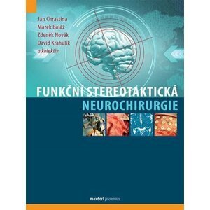 Funkční stereotaktická neurochirurgie - Novák Zdeněk, Krahulík David, Chrastina Jan, Baláž Marek,