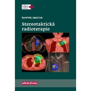 Stereotaktická radioterapie - Jakub Cvek