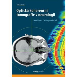 Optická koherenční tomografie v neurologii - Jana Lízrová Preiningerová