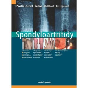 Spondyloartritidy - Karel Pavelka; Ladislav Šenolt; Liliana Šedová