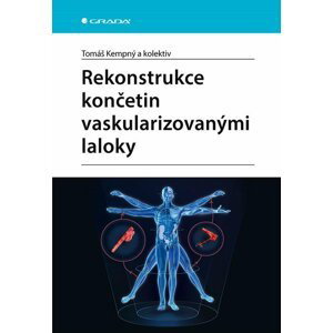 Rekonstrukce končetin vaskularizovanými laloky - Tomáš Kempný