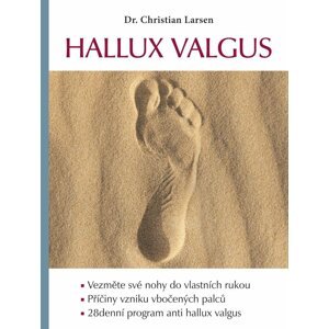 Hallux valgus - Christian Larsen