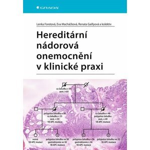 Hereditární nádorová onemocnění v klinické praxi - Lenka Foretová