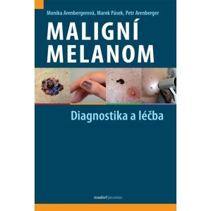 Maligní melanom - Diagnostika a léčba - Monika Arenbergerová