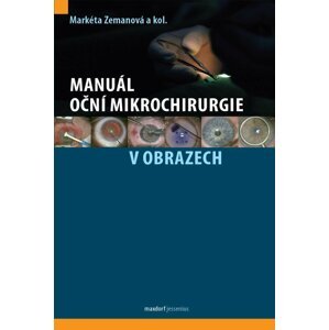 Manuál oční mikrochirurgie v obrazech - Markéta Zemanová